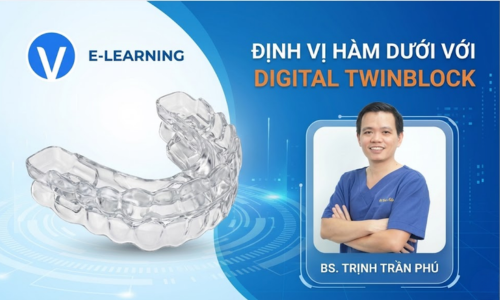 Định Vị Hàm Dưới Với Digital Twinblock